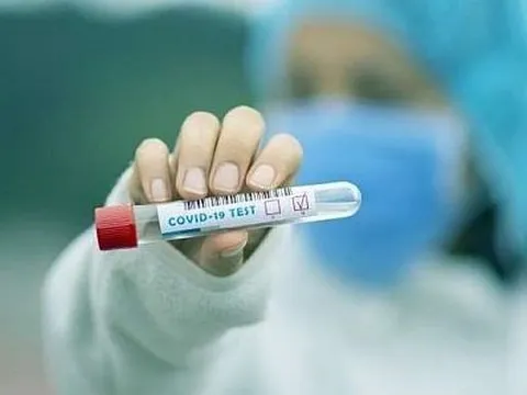 Độ nhạy của xét nghiệm vi rút COVID-19 thay đổi theo nhịp sinh học của cơ thể