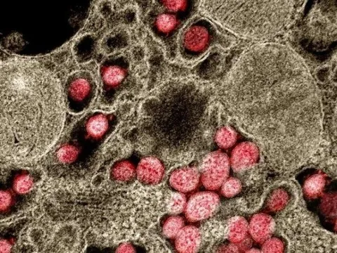 Kẹo cao su giúp giảm lây nhiễm nCoV