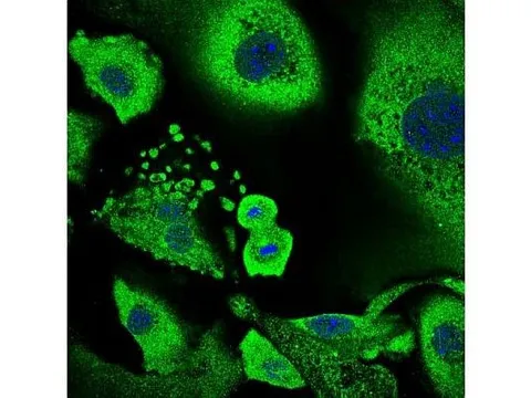 Protein CSDE1 có thể ức chế khối u