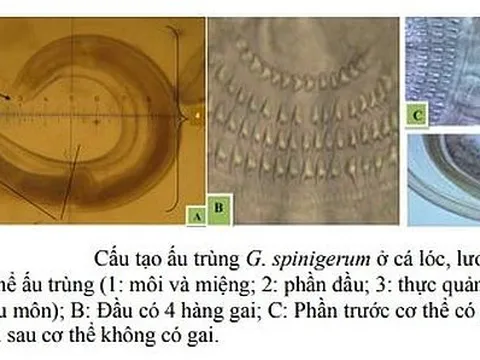 Nghiên cứu một số đặc điểm dịch tễ, lâm sàng, cận lâm sàng của bệnh giun đầu gai ở người tại một số điểm miền Trung - Việt Nam