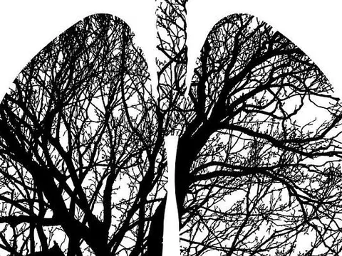 Công bố phân tích quốc gia mới về ghép phổi COVID-19 tại Hoa Kỳ